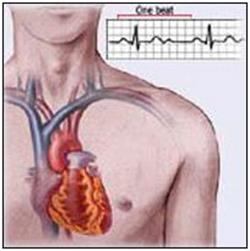 Нарушение внутрижелудочковой проводимости - Всё о сердце