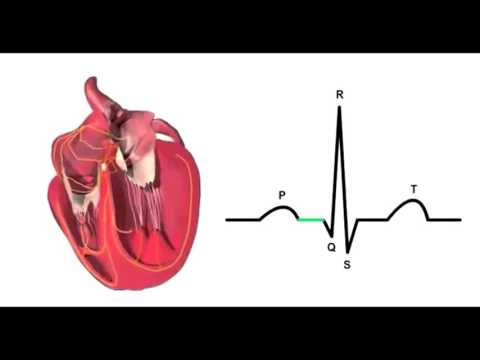 На кардиограмме сердца синусовый ритм: что это - Всё о сердце