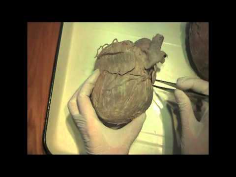 Коронарные артерии - Всё о сердце