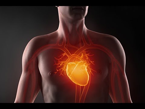 Инфаркт сердца - Всё о сердце