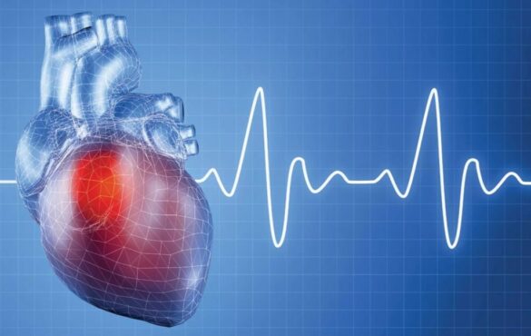 Какие болезни сердца бывают - Всё о сердце