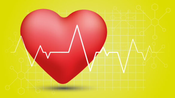Лечение аритмии сердца в домашних условиях - Всё о сердце